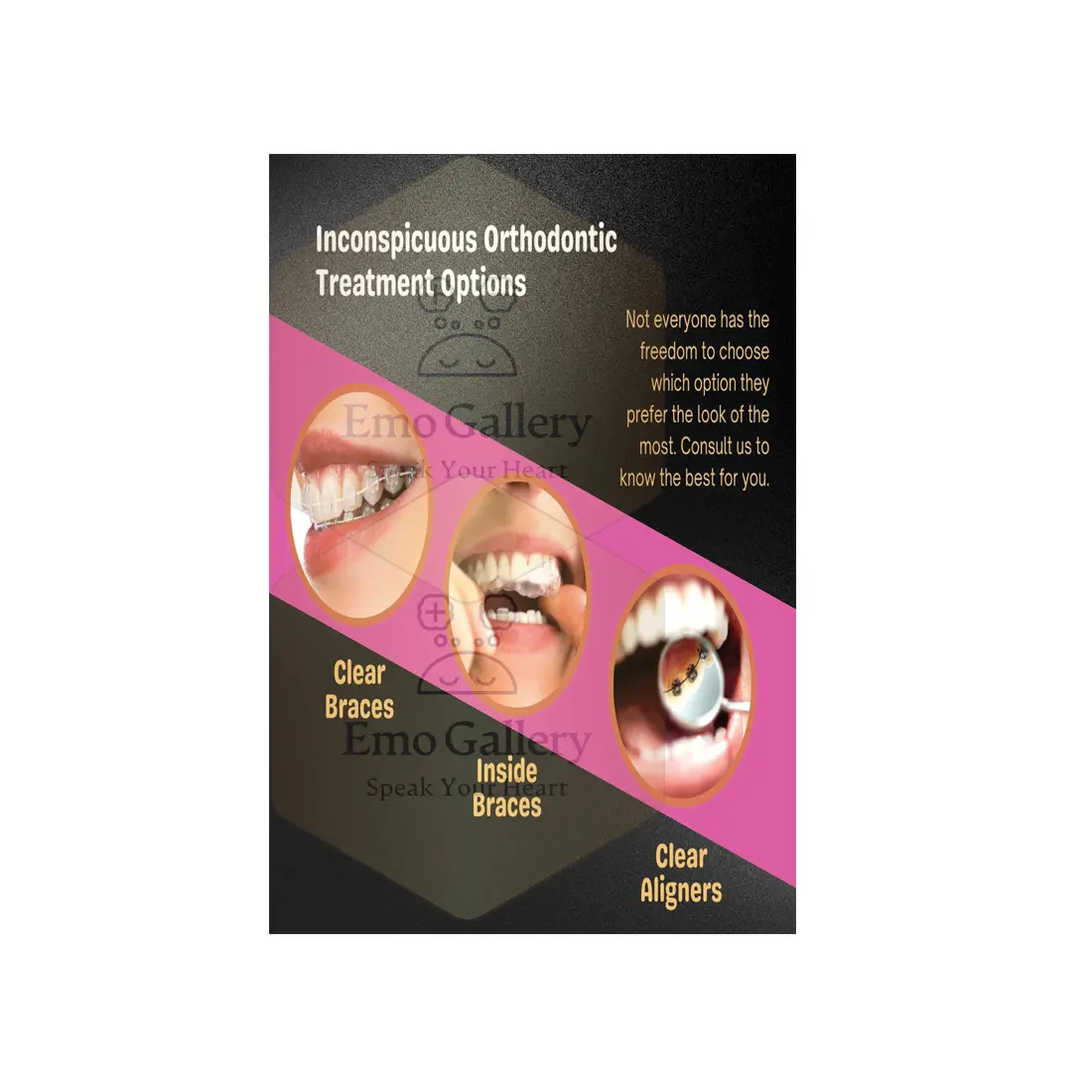 Orthodontics Braces Treatment Poster Self Adhesive | Teeth Straightening Educational Chart | Dentist Clinic Wall Poster Orthodontic treatment self adhesive poster showing braces and teeth alignment awareness chart for dental clinic wall decor, waterproof educational dental poster