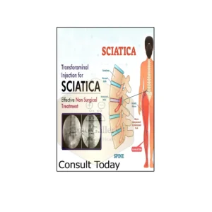 Sciatica - Symptoms Poster