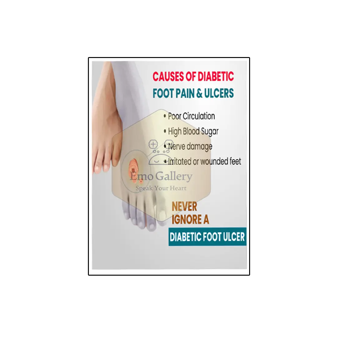 Causes of Diabetic Foot Pain & Ulcers Poster | Diabetes Foot Care Awareness Wall Decor Causes of diabetic foot pain and ulcers poster showing common diabetes-related foot problems for clinic and hospital awareness.