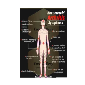 Rheumatoid arthritis symptoms poster showing joint pain, swelling, stiffness, and inflammation for clinic and hospital awareness.